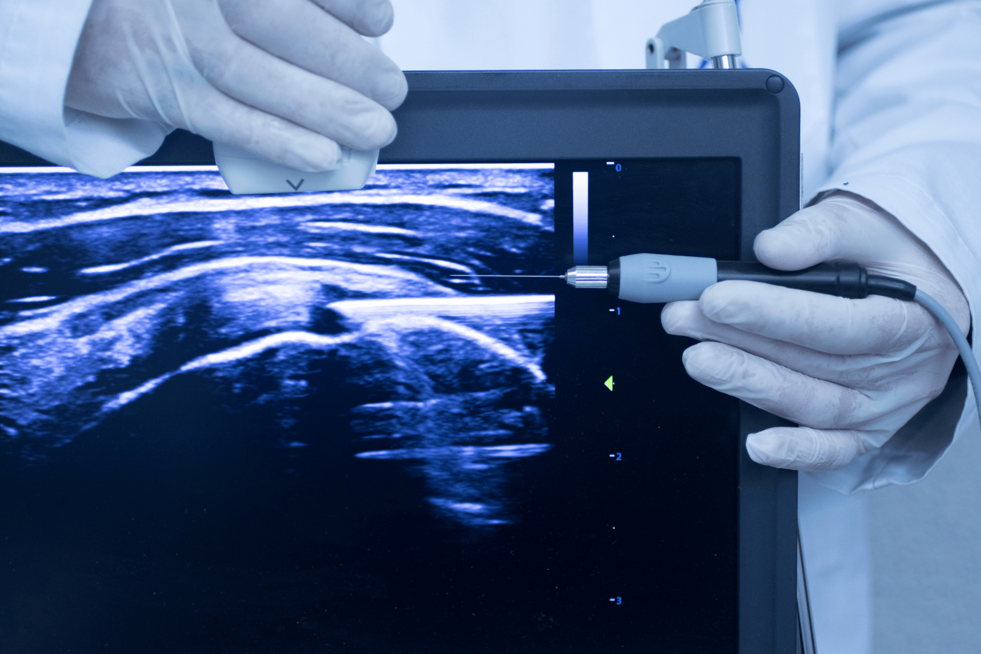 Ultrasound-min Ultrasound-min