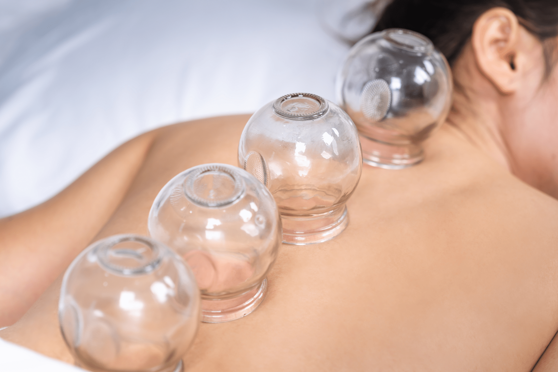 cupping-min cupping-min