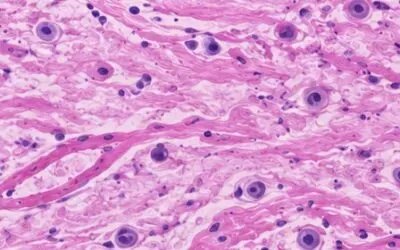 The Wear and Tear You Can’t See: How Chronic Inflammation Undermines Connective Tissue Strength